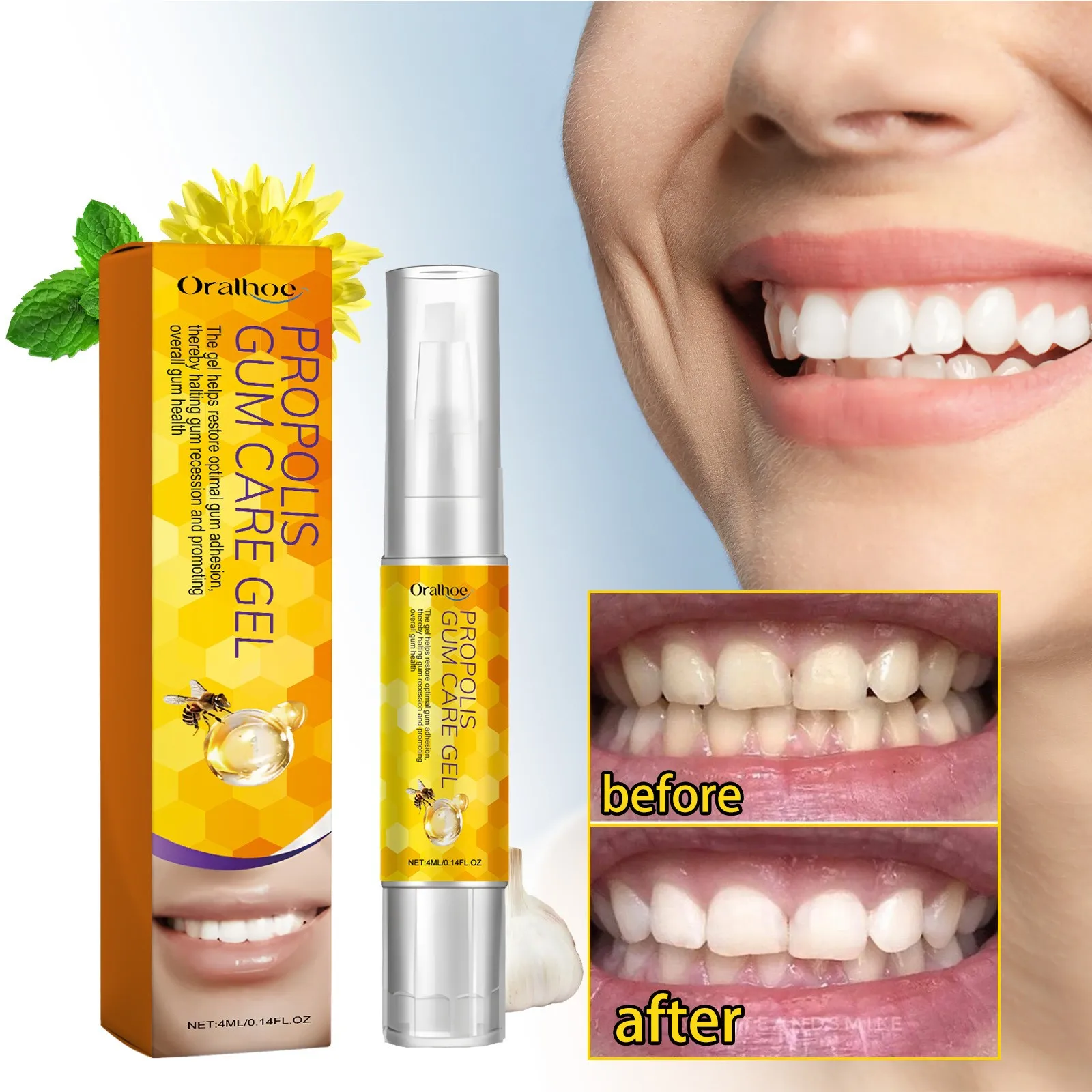 Teeth Care Beauty Gel Set Teeth Whitening Remove Stains Yellow Teeth Improve Oral Hygiene Gel