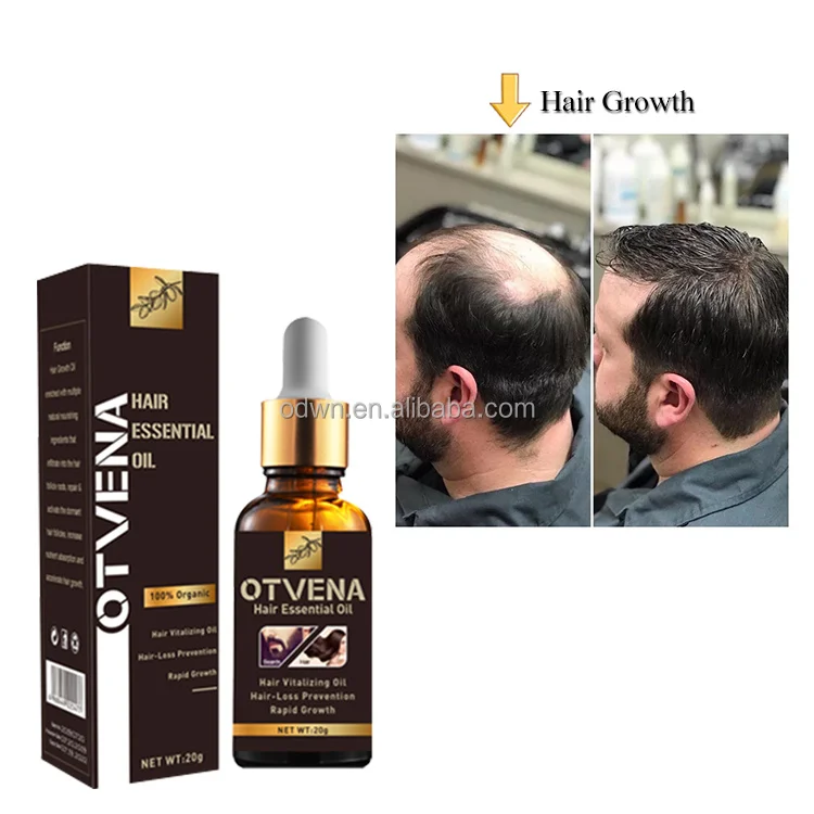 Hot Sale Thailand 20ml Hair lotion Growth Serum Oil Hair Loss Treatment Growth Hairs For Men Women