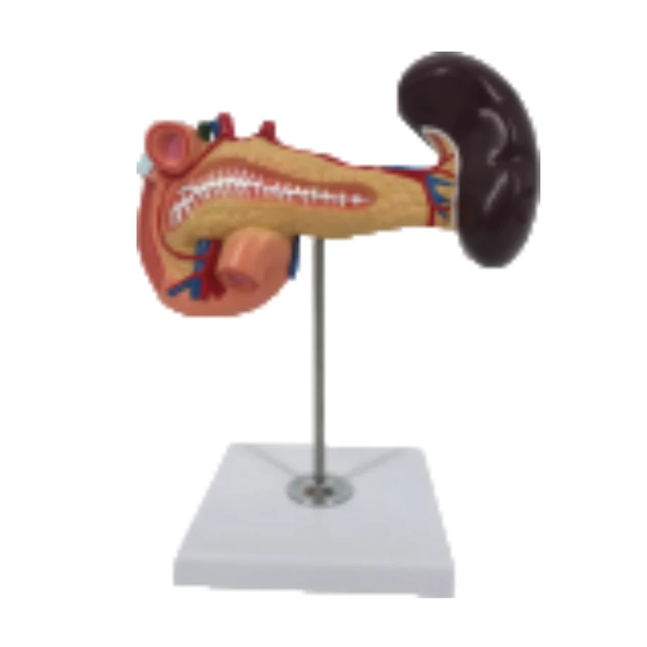 ADA  Pancreas, duodenum spleen models and Pancreatic bile duct pathological model with Pancreatic bile duct pathological model