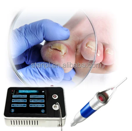 Заводская цена 1470nm 980nm диодное лазерное оборудование для лица lsser lipolysis vaser липосакция 30W 17w лазерная машина