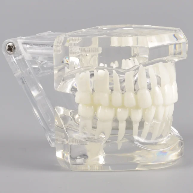 Новая модная Стоматологическая прозрачная модель, ортодонтика без кронштейнов