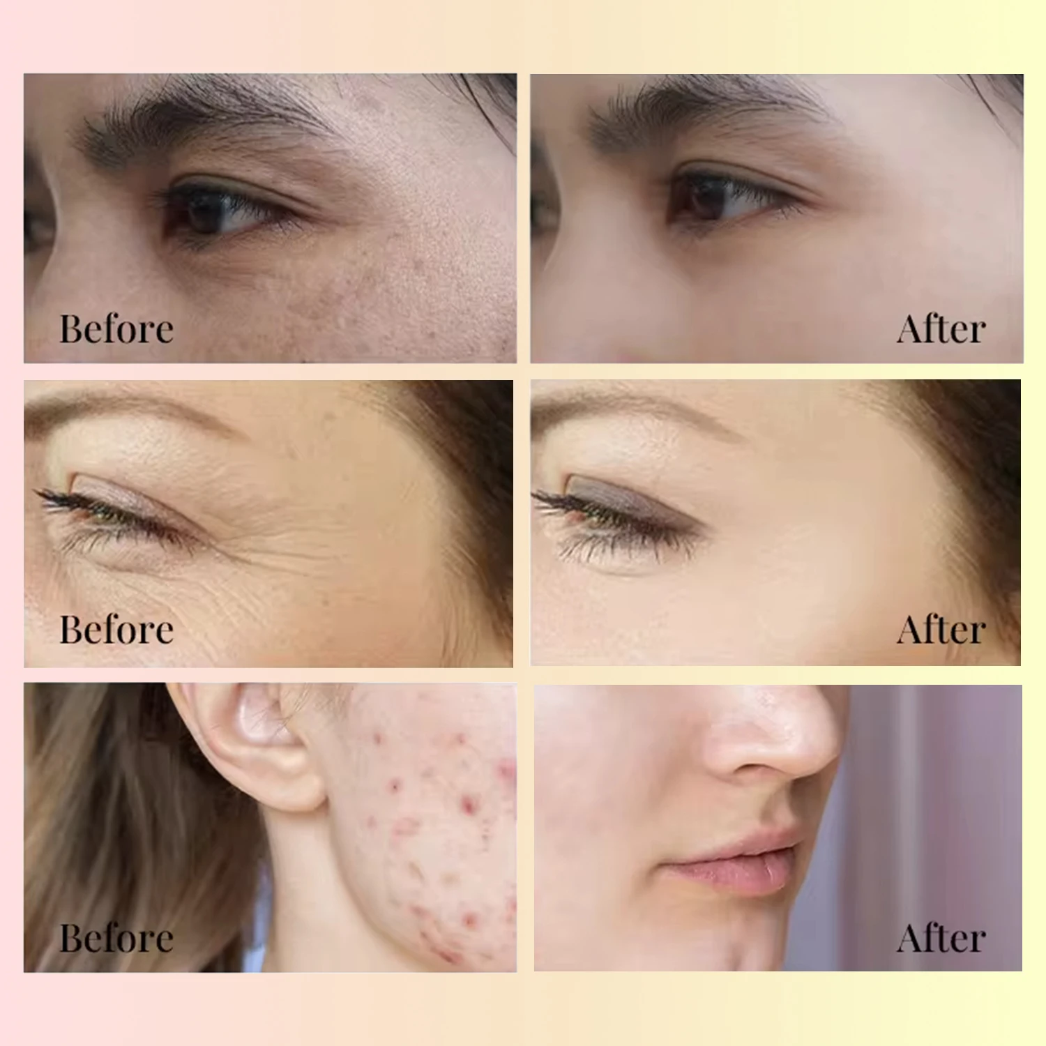 Private Label Facial Skin Care Face Serum Moisturizing Whitening Natural Organic Anti-acne Repair Collagen Retinol Serum