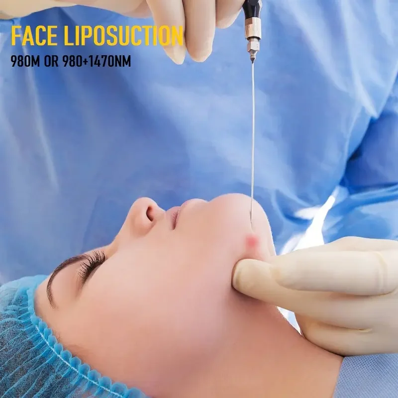 2024 Professional 300um 400um 600um skin tightening facial lifting 1470nm Laser Liposuction clinic use device