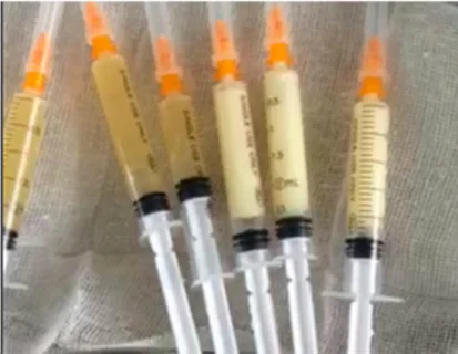 Plasma gel machine Platelet rich plasma machine