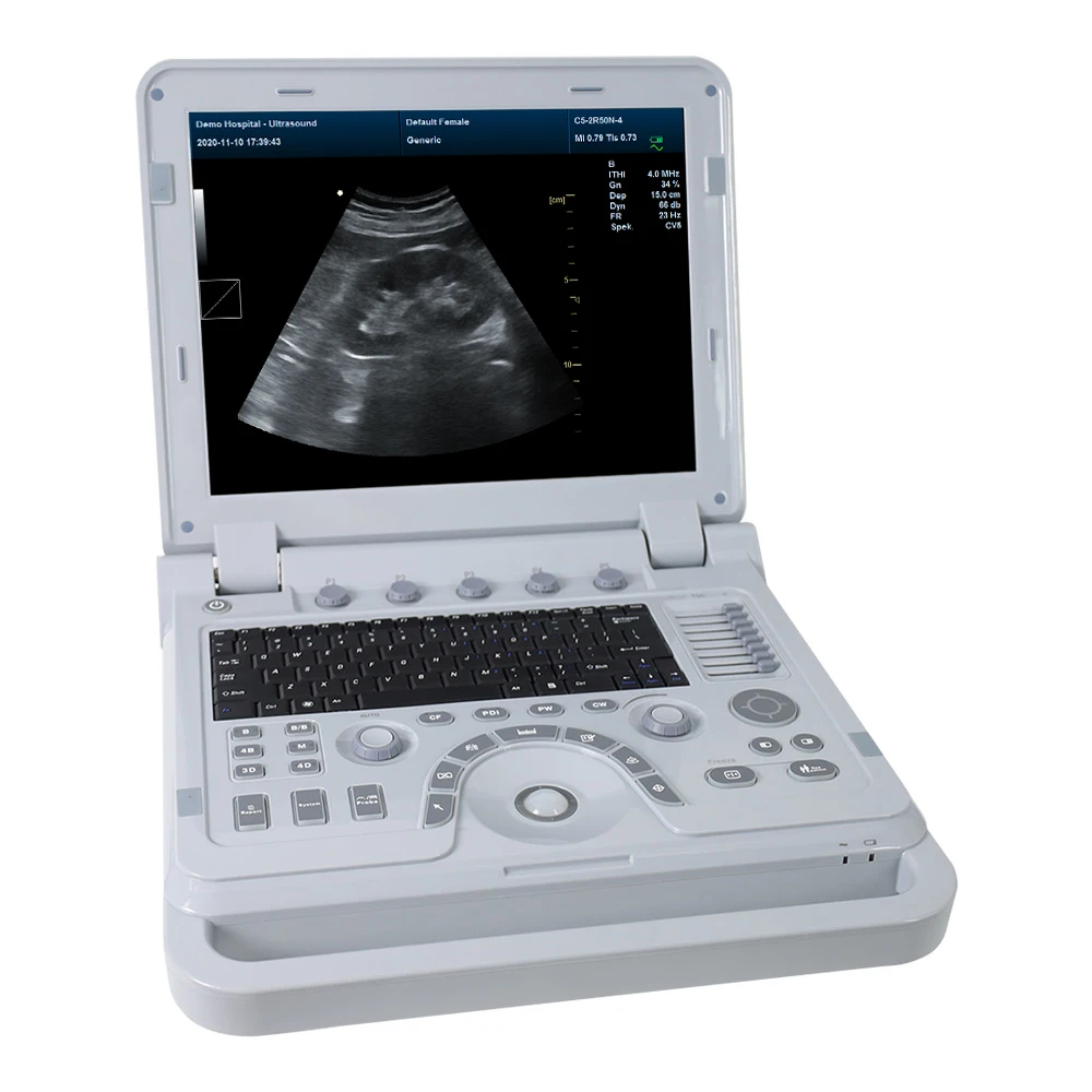 CONTEC CMS1700B 3d and 4d ultrasound scanner laptop ultrasound color doppler