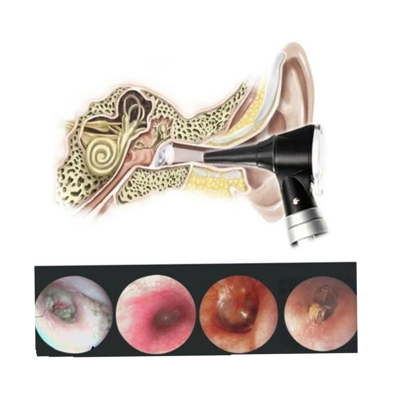 Fiber Optic LED Otoscope Ophthalmoscope ENT Diagnostic Examination Kit Surgical Lab Device