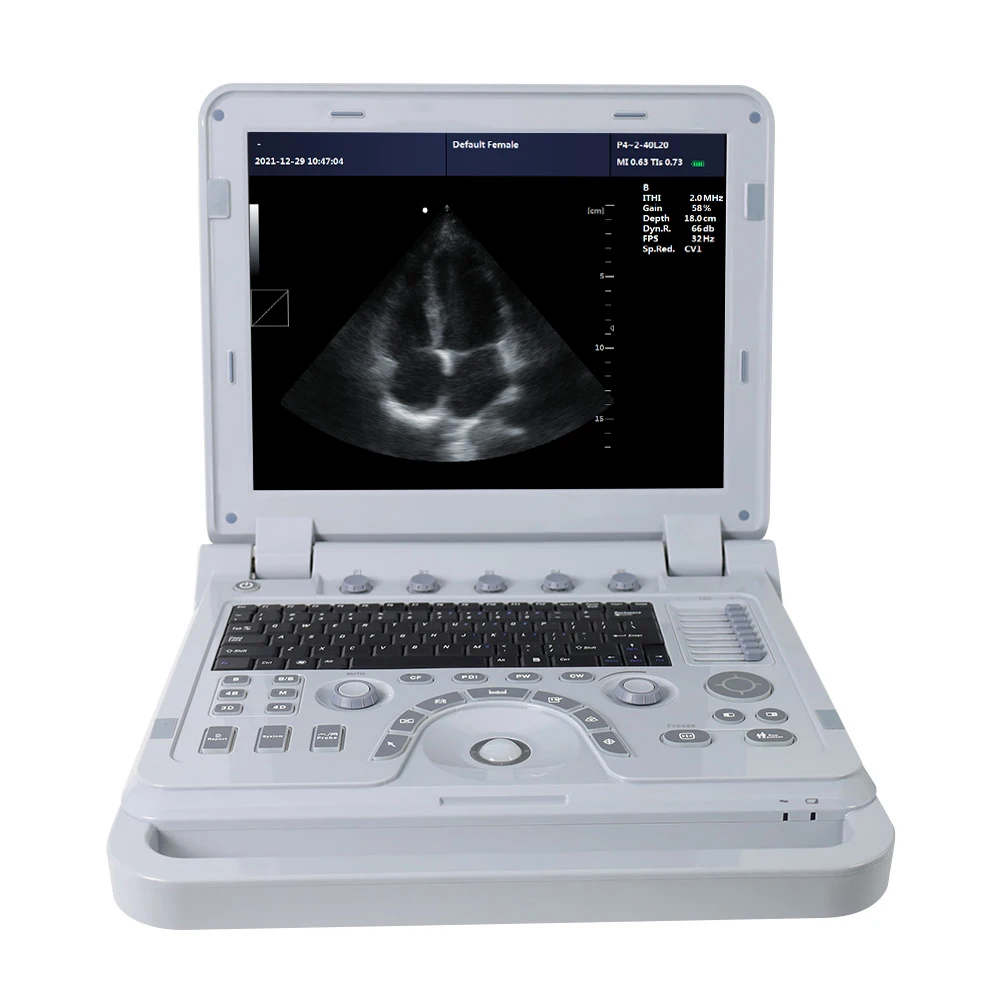 CONTEC CMS1700B medical echocardiogram ultrasound machine color doppler laptop echographie ultrasonic scanner