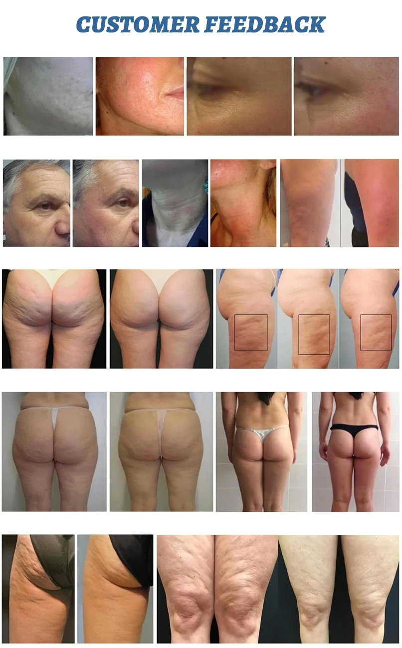 Factory Cellulite Reduction Body Contouring Lymphatic drainage therapy 360 Rotating 8d Slim Inner Ball Roller Machine endosfera