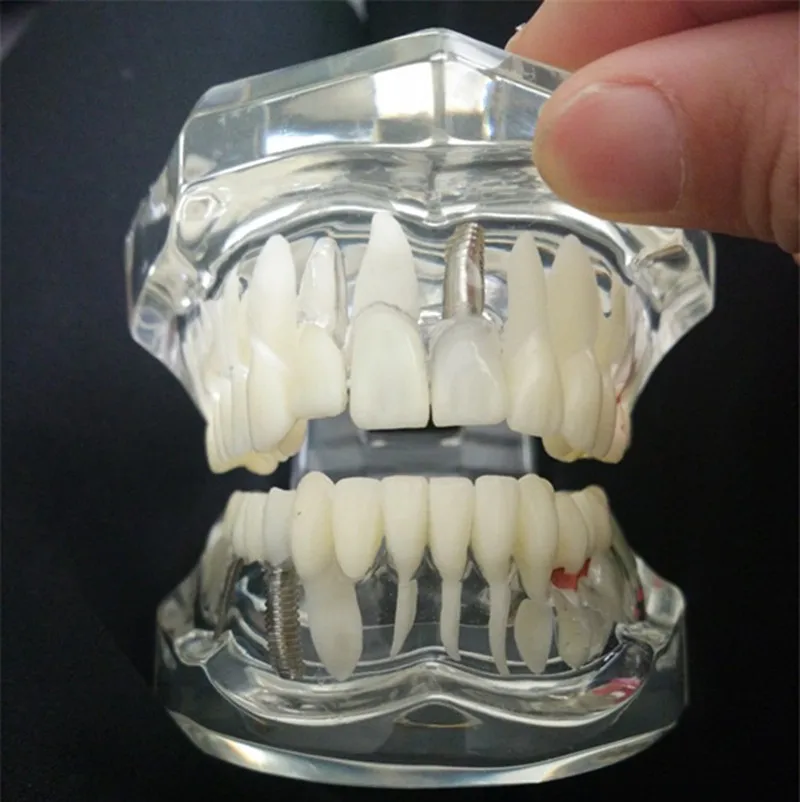 teeth can be removable dental activity pathological model teeth model