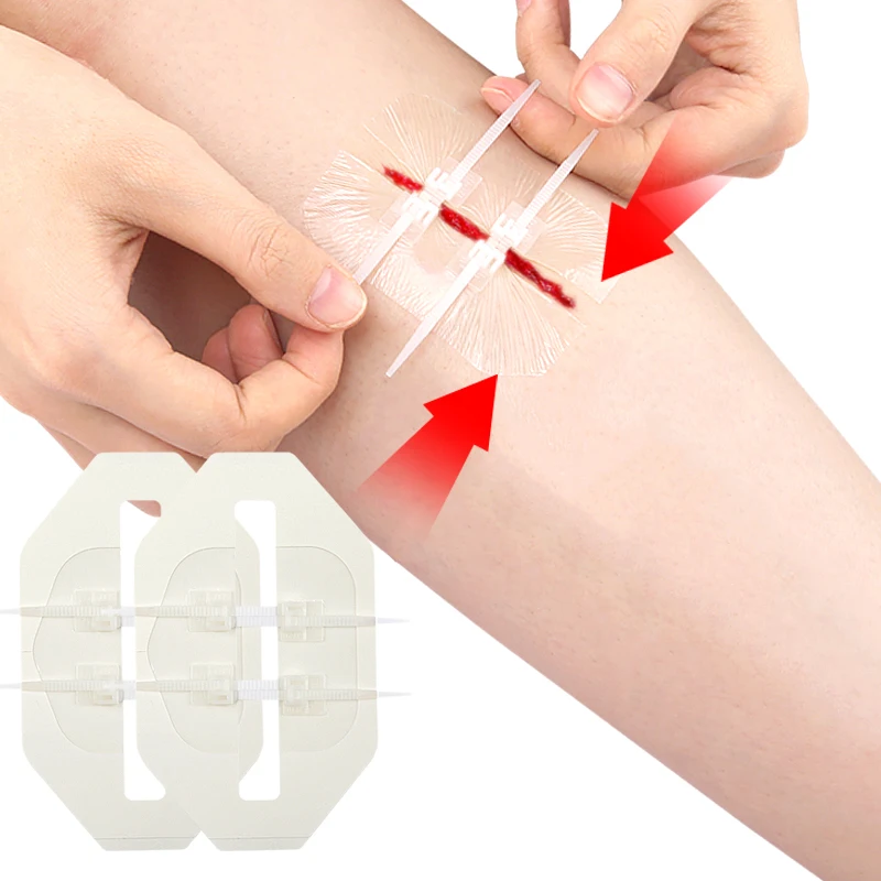 Elastic Band Wound Patch PU Transparent Zipper Skin Non Sewing Lock Buckle Pulling Self Adhesive Bandage Patch