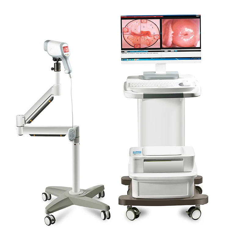 Top Grade Popular Digital Optical Colposcope Portable Mobile High Definition Camera Colposcope for Gynecology