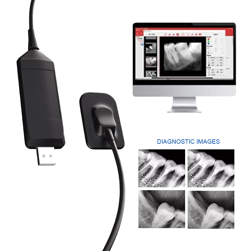 Refine HD Image Dental Intraoral Digital Xray Radiography Sensor System Portable Digital Dental RVG X Ray Sensor