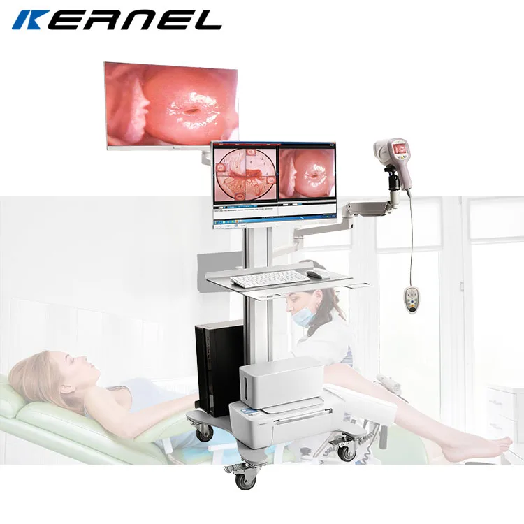 2024 Newest Kernel KN-2200IH Portable Electronic Video Colposcop Camera Digital Video Vagina Colposcope for Gynecology