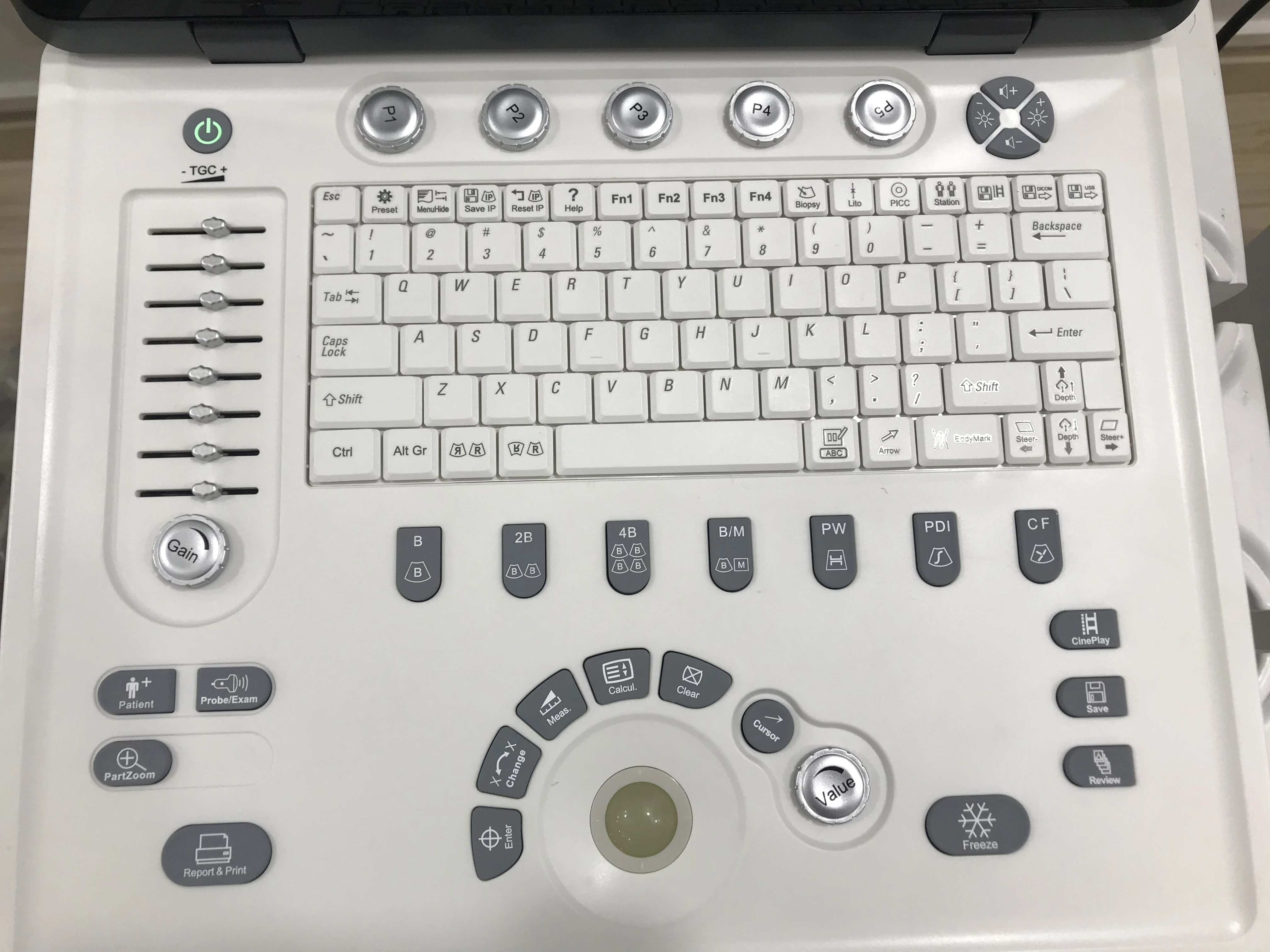 High quality machine color doppler ultrasound ultrasound machine color doppler ultrasound color doppler laptop