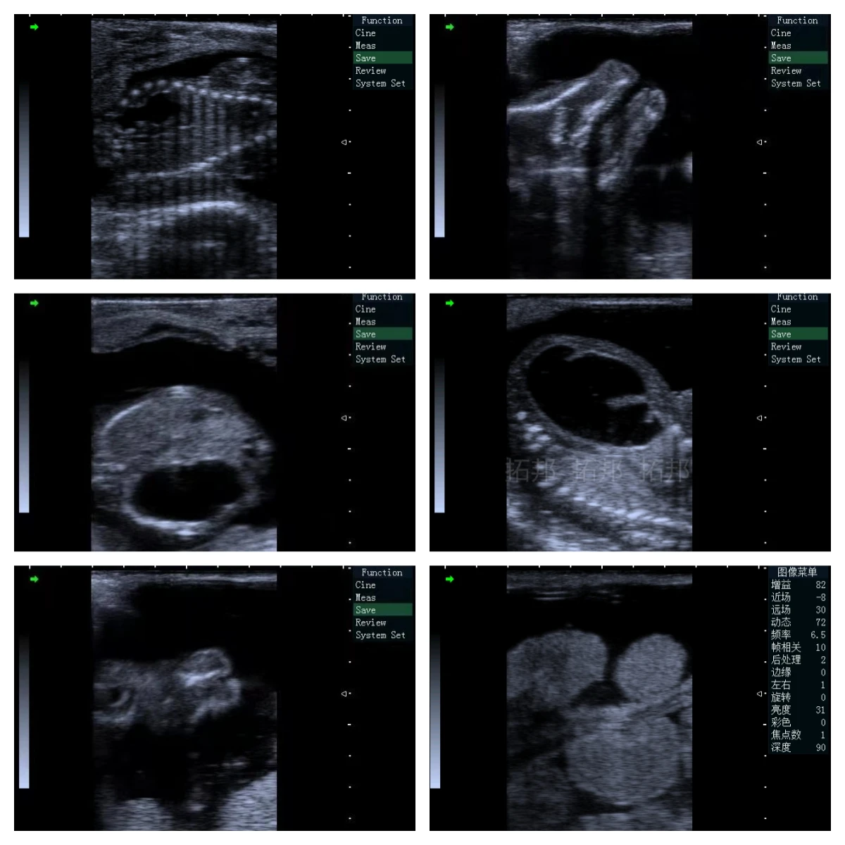 Ce Certified Portable Veterinary Handheld Ultrasound High Resolution Animal Echo Device For Cattle, Horse