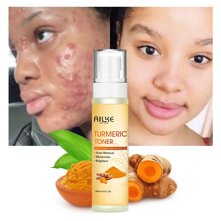 ailke 100% Organic Vitamin C Nicotinamide Anti Acne Moisturizing Turmeric Facial Toner For Black Skin (1600630094711)