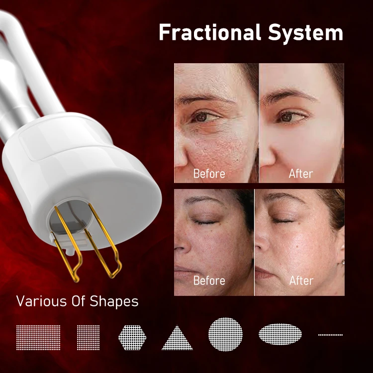 2024 latest hot-sale Laser Co2 Fractional/  Fractional Co2 Laser 980nm RF Tube Vaginal Tightening machine laser skin resurfacing