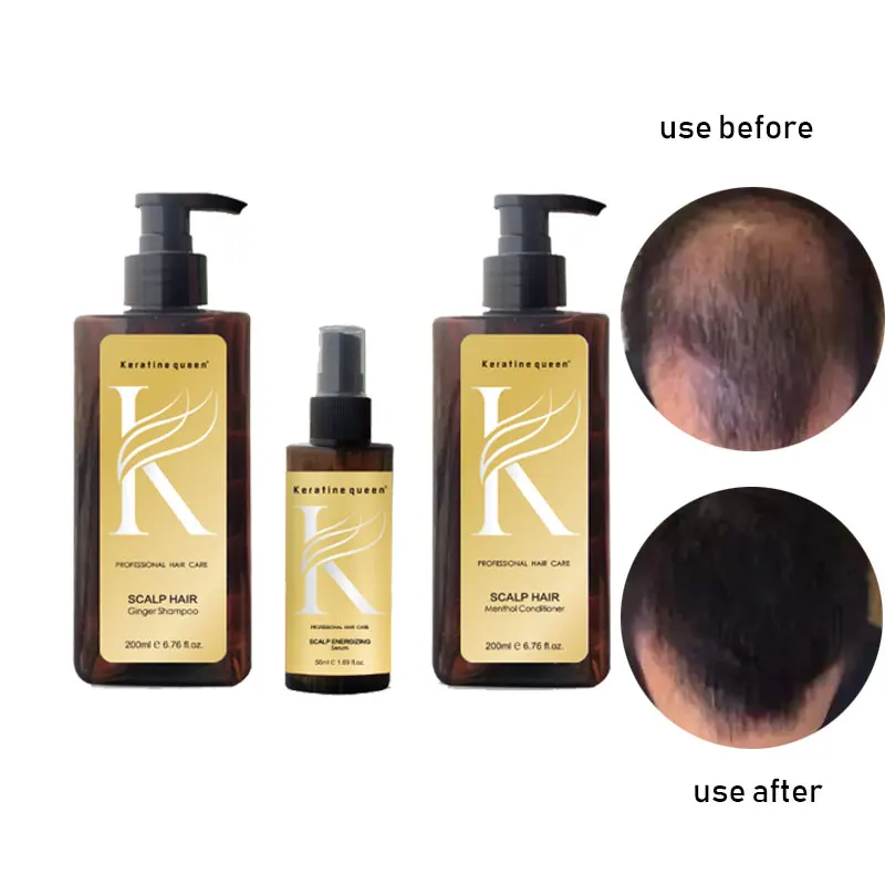 Под заказ натуральные волосы и органический имбирный шампунь и кондиционер для быстрого роста волос