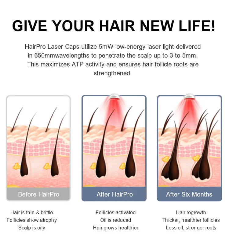 haircare 200pcs Medical Lasers diodes  Hair loss 510k medical  IR infrared red  therapy  help hair growth helmet at home