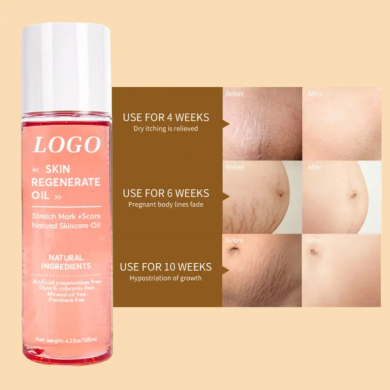 Aixin Private Label Natural Organic Stretch Body Oil Repair Hydrates Stretch Marks And Scar Removal Oil