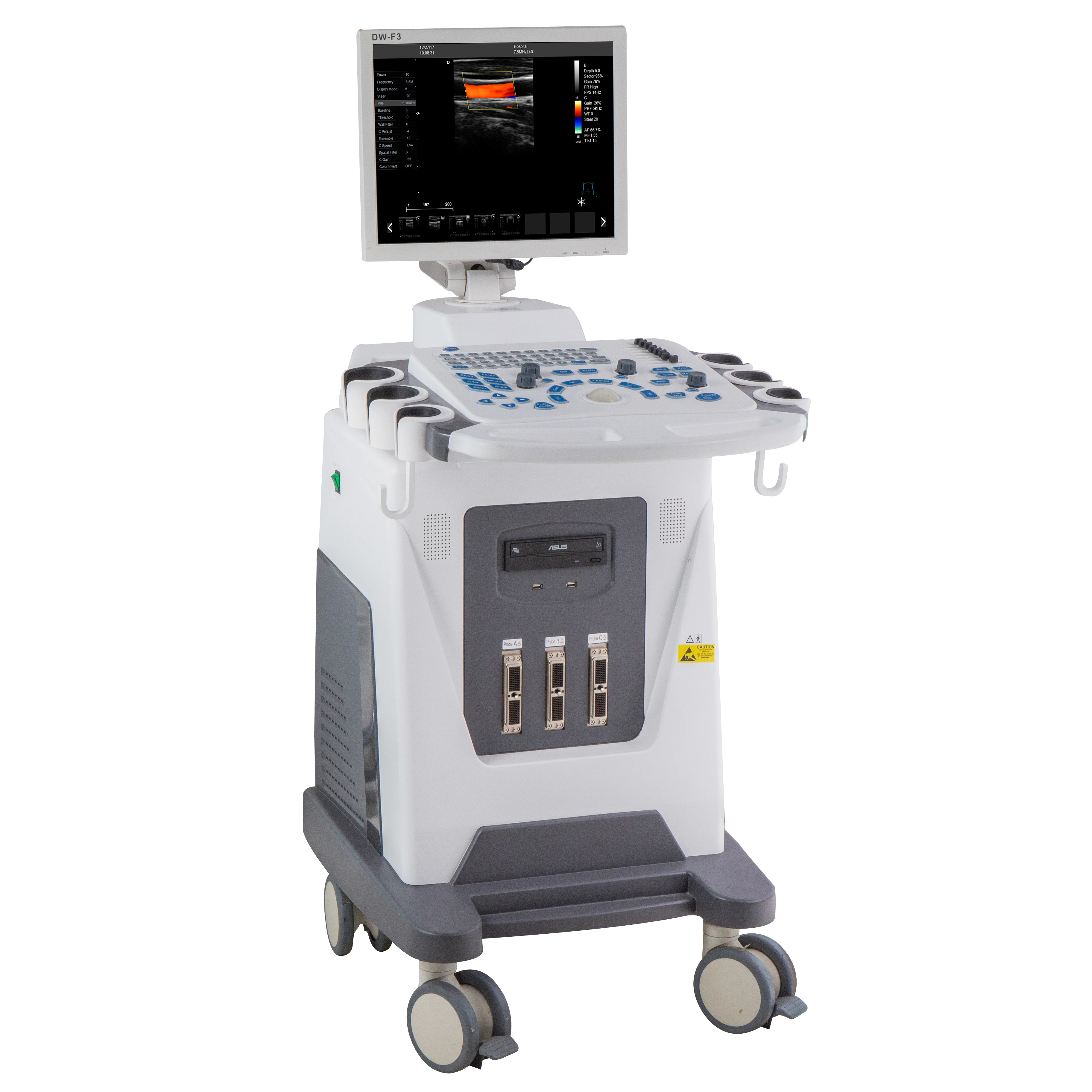 new tech color USG & real time color doppler & doppler ultrasound machine for pregnancy