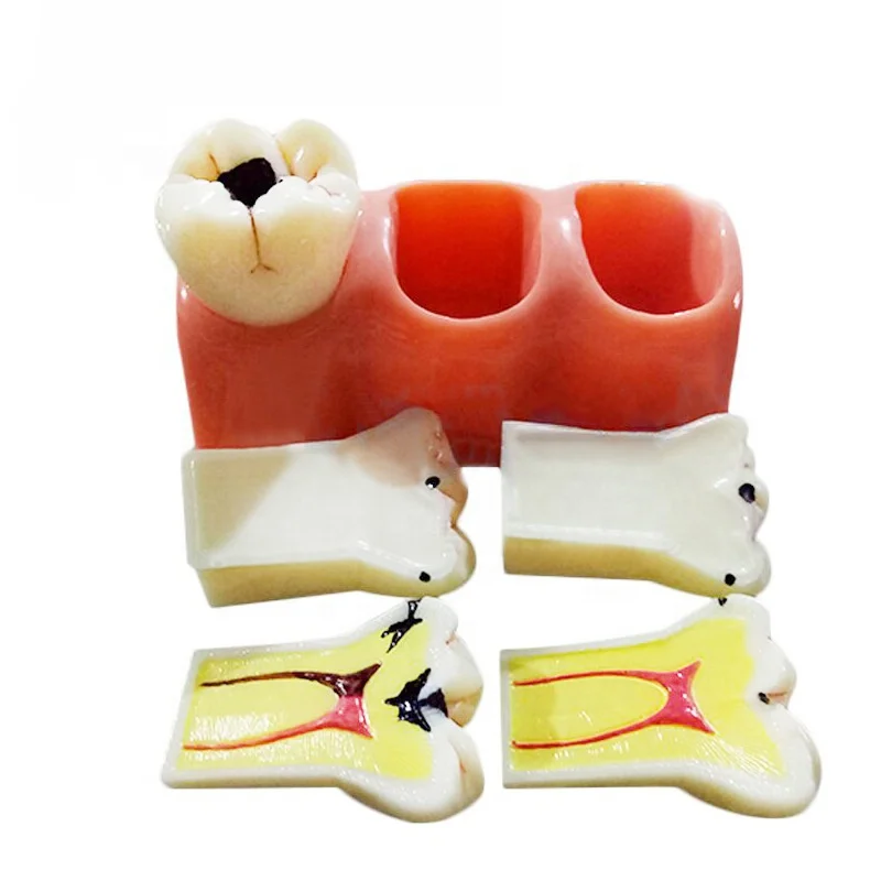 Demonstration Study teeth model orthodontic permanent  teeth model plastic