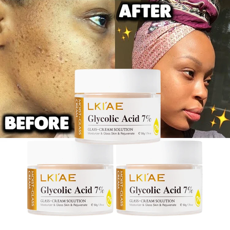 High Quality 7% Glycolic Acid Anti-Acne Skin Care Brightening Reduce Fine Lines Wrinkle Firming Moisturizing Face Cream