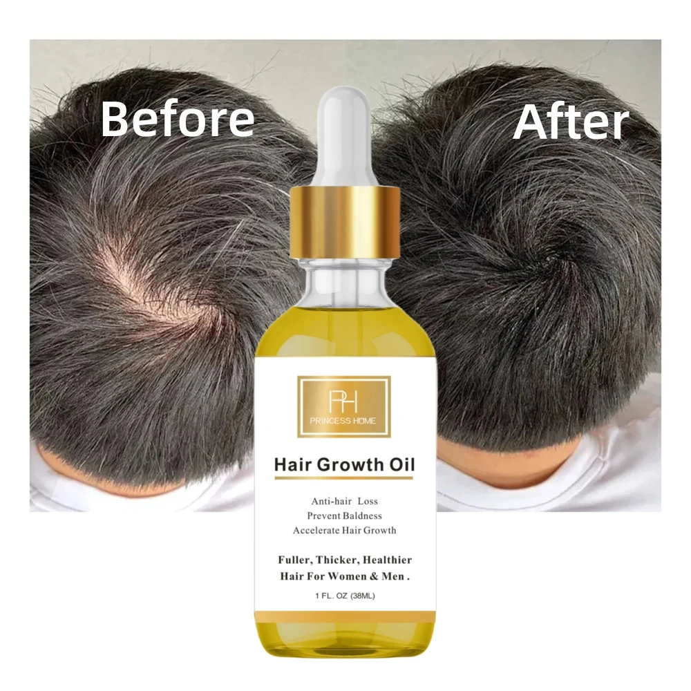 Wholesale Private Label 100% Natural Rosemary & Biotin Nourishing Scalp Oil Hair Care Loss Treatment Serum Hair Growth Oil