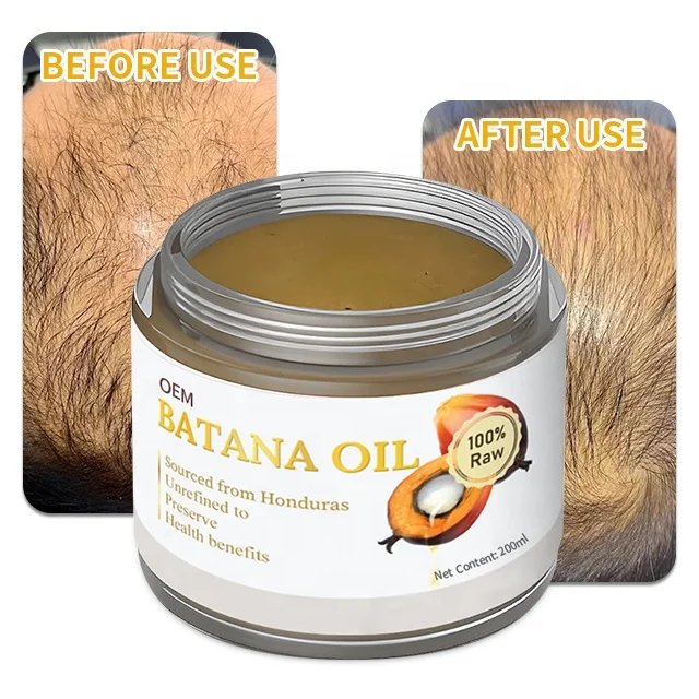 Hair Growth Batana Oil For Men And Women Natural Formula Organic Ingredients Batana Oil For Hair Regrow