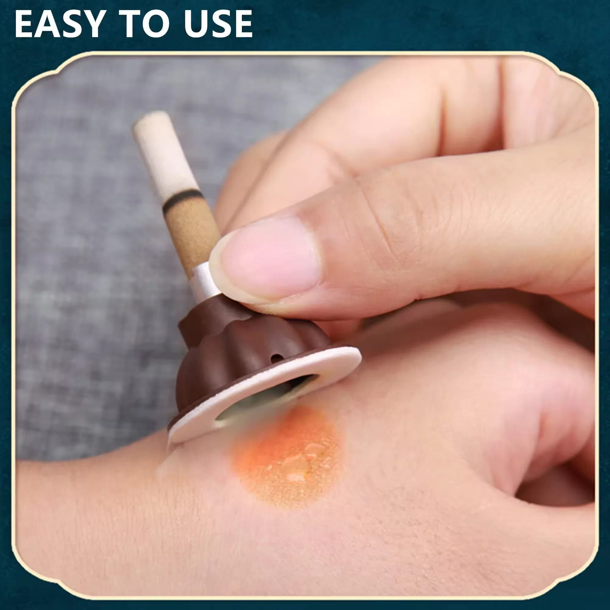 New Portable moxibustion product with magical curative effect to dispel cold and dampness, and smooth meridians and acupoints