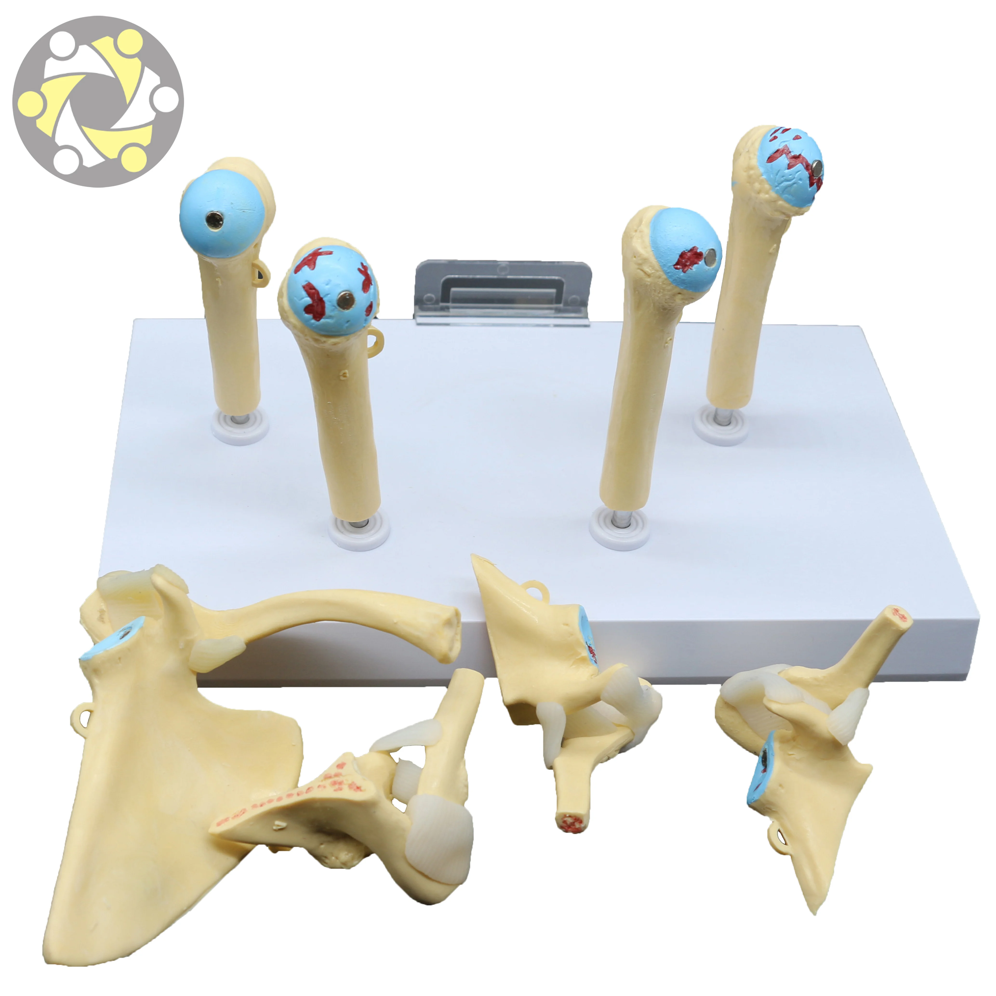 Medical Science Skeleton Model Human Diseased 4 Stage Osteoarthritic Shoulder Model for Teaching