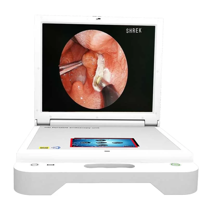 portable endoscopy unit with rigid laryngoscope price from china endoscope manufacturer