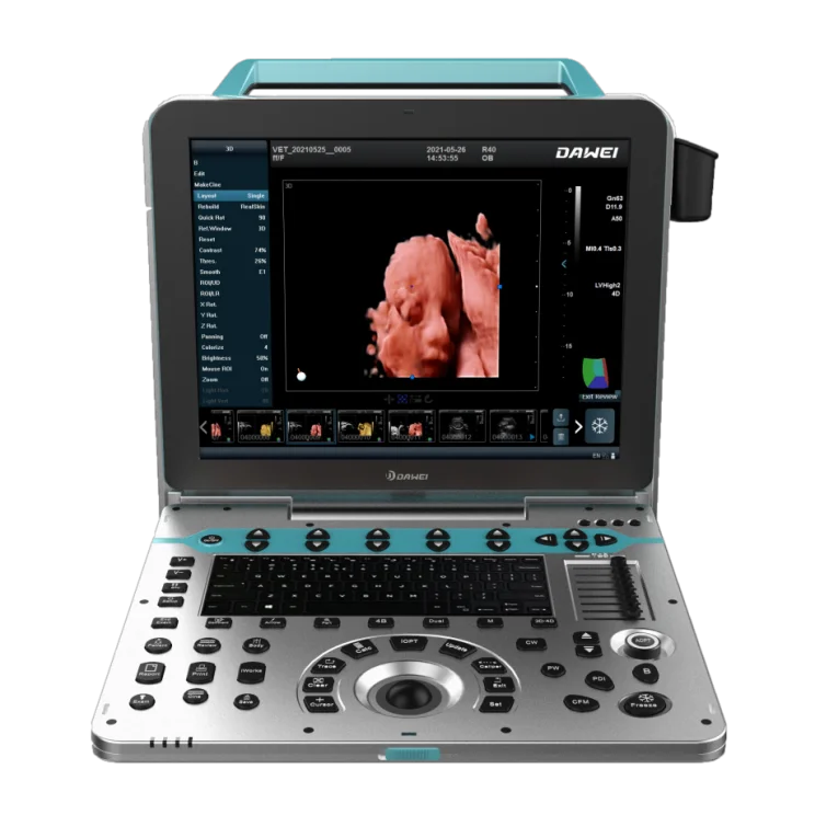 Dawei Brand DW-P50 4D/5D portable color doppler ultrasound machine system with High Quality