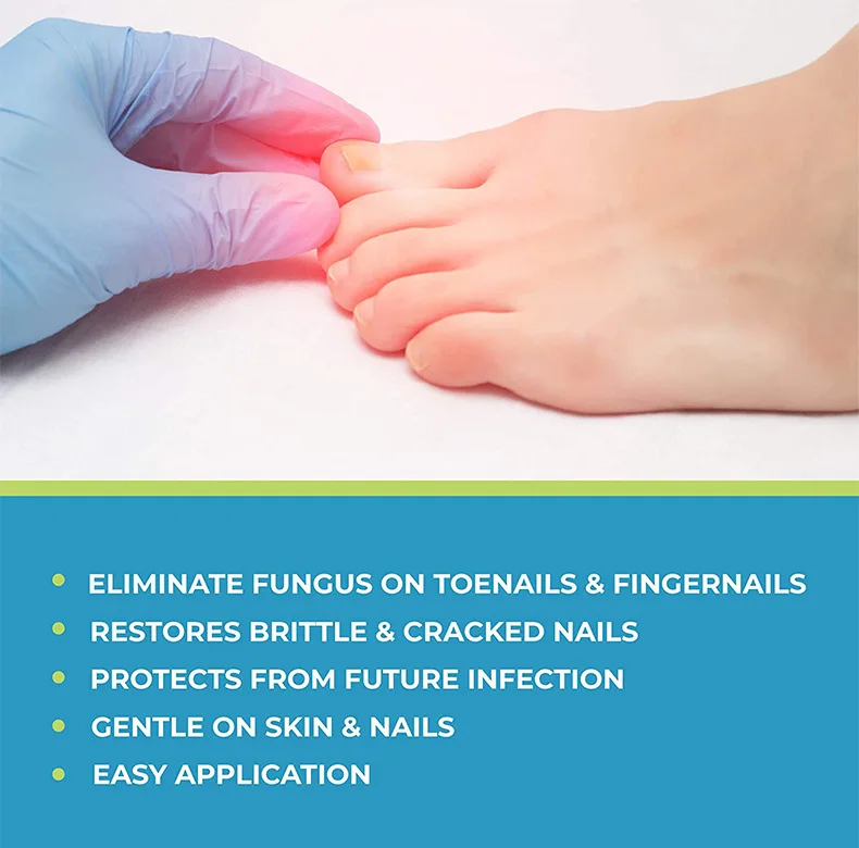 Newest Design Natural Herbal Onychomycosis Repair Liquid Nail Nail Fungus Treatment Pen