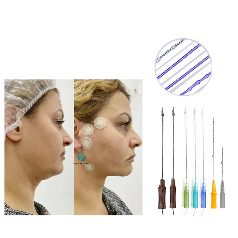 CE certificate Korean molding PCL 4D Cog Thread L Blunt cannula face lift nose eyes lift thread for V lifting