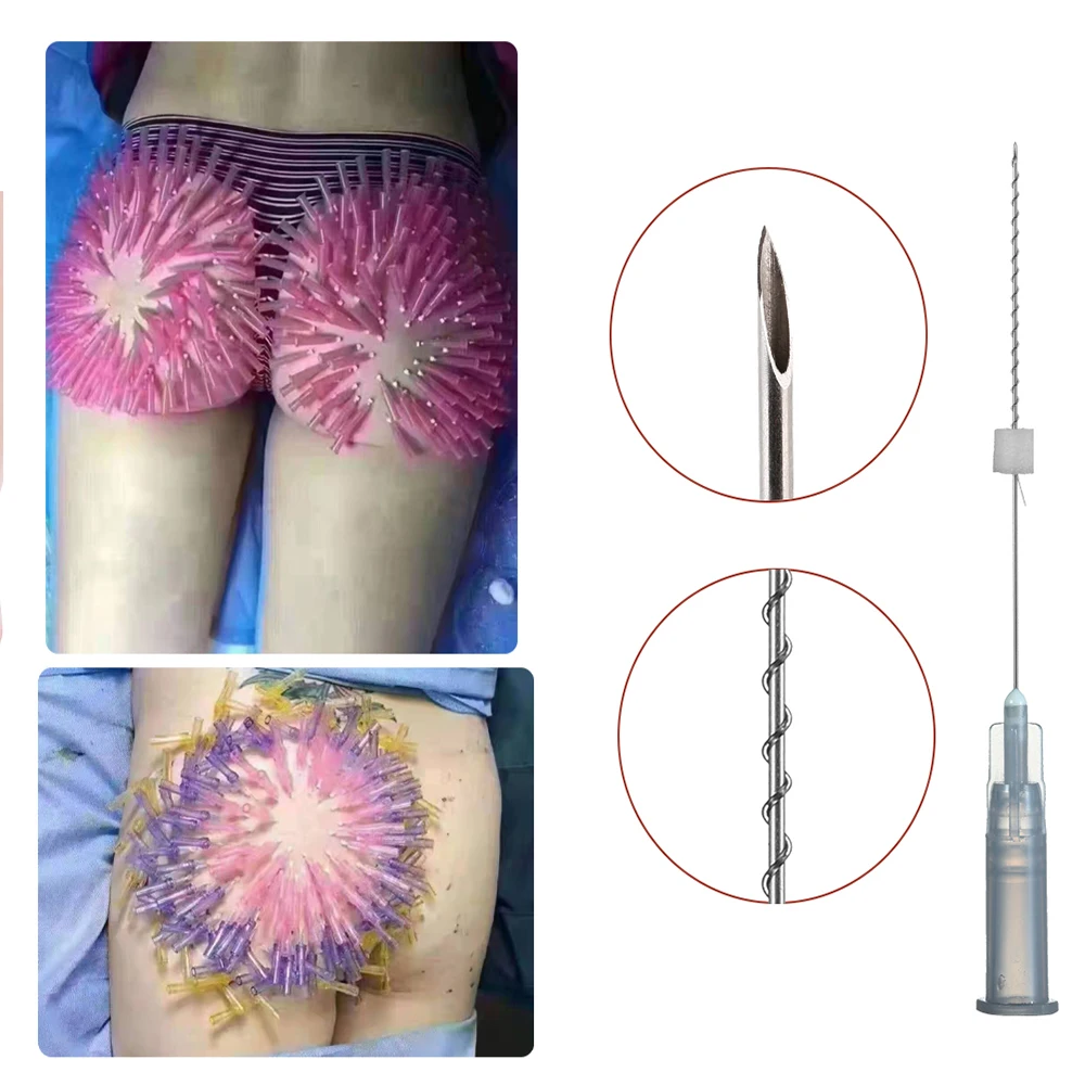 Simple Operation 30g 25mm Neck Skin Tightening Face Lifting Hilos Tensores Mono Screw Pdo Thread