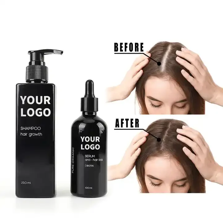 Supplier Wholesale Oil Control Anti Loss Hair Natural Regrowth Treatment Scalp Elixirs Hair Growth Oil Serum shampoo kits