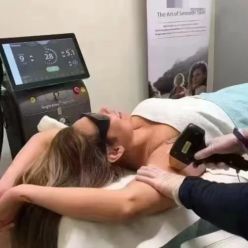 hair removal machine non channel diode laser 755nm 808nm 1064nm Diode Laser Hair Removal machine trade