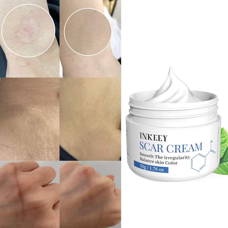 Scar Removal Cream ForSkin Care Scar Removal  Butter  whitening cream