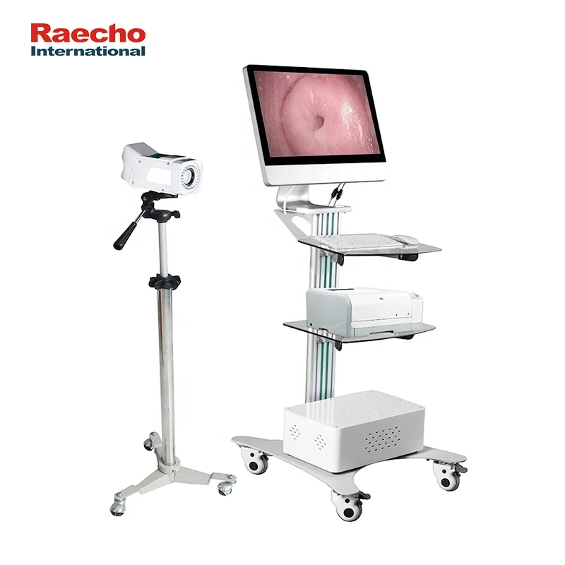 New Arrival Portable Vagina Colposcopy Gynecology Digital Video Colposcope Camera Machine
