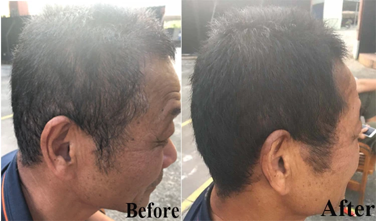 
Factory Price Free Samples Fast Noni Permanent Black Hair Shampoo 