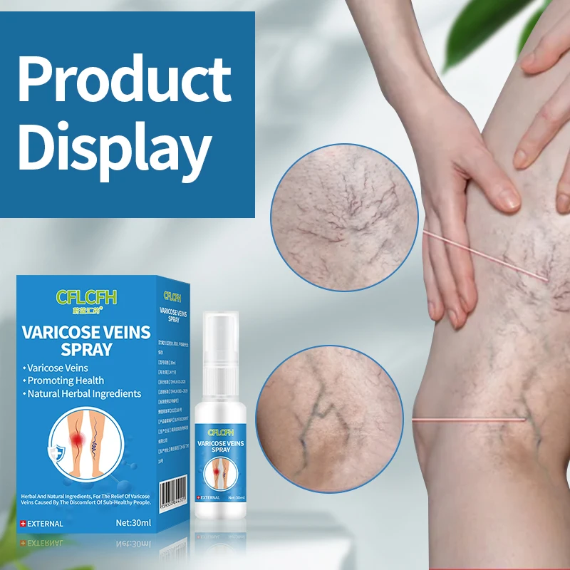 Varicose Vein Spray Spider Varicose Veins Relief cream Herbal Ointment 30ml