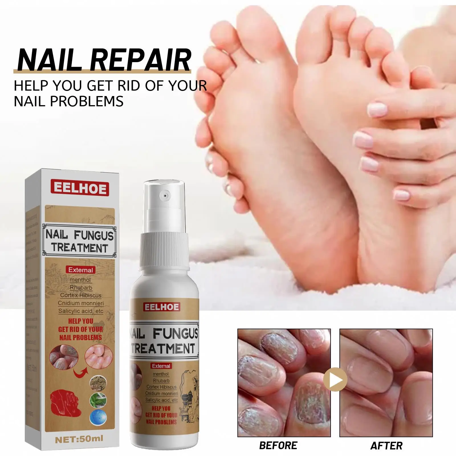 Costom Fungal Nail Repair Spray Nursing Treatment Anti-Infective Paronychia Onychomycosis Care  Foot Nail Fungus Removal Gel