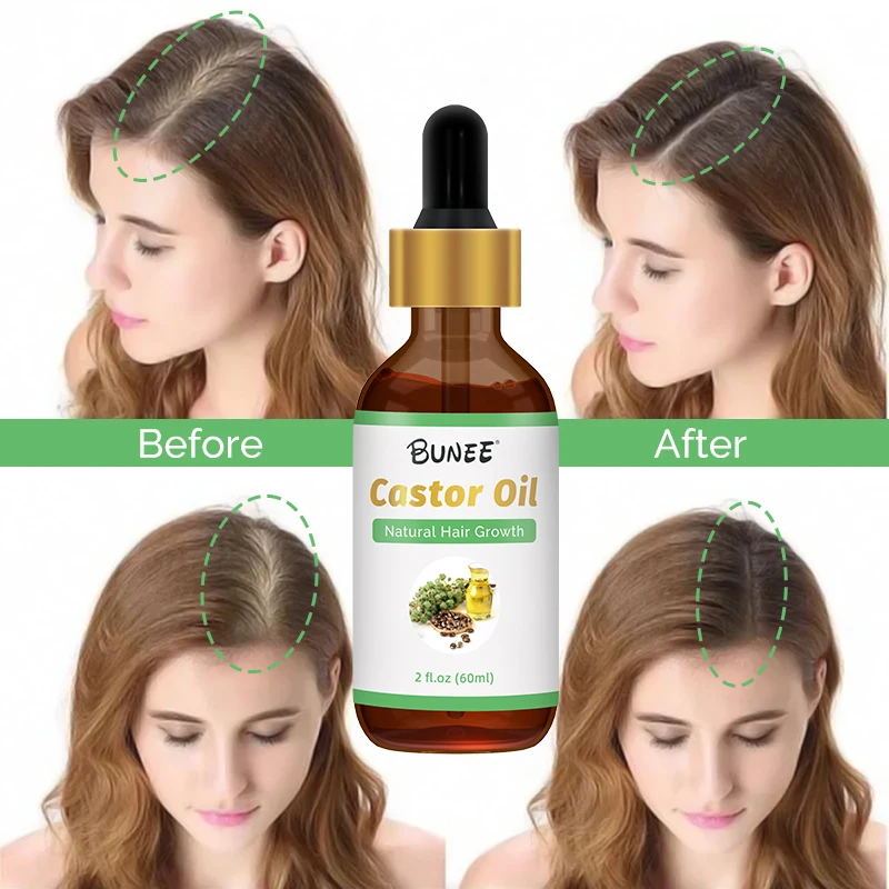 Hot Products organic castor oil black seed oil cold pressed black castor oil jamaican natural fast hair growth With Hot sale