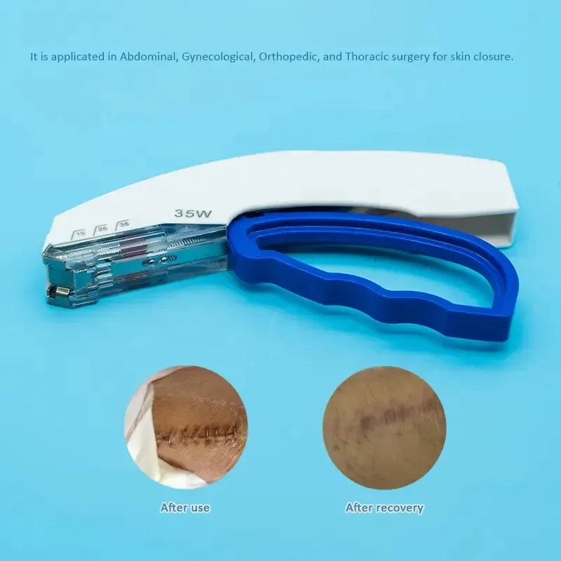 Medical surgical Disposable 35w skin staplers and remover with 35 Wide Staples