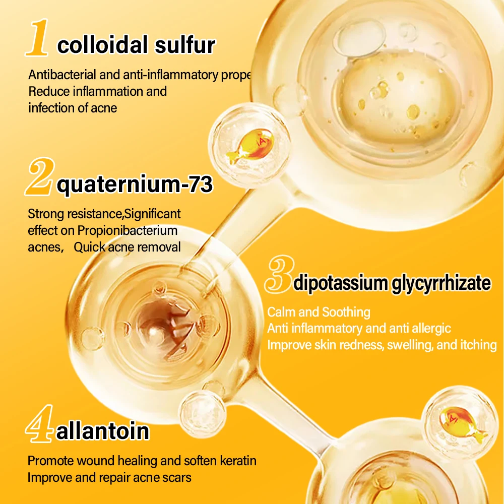 Colloidal Sulfur Anti-acne Serum For Acne Treatment Balancing Water Oil Improving Acne Scars Face Serum