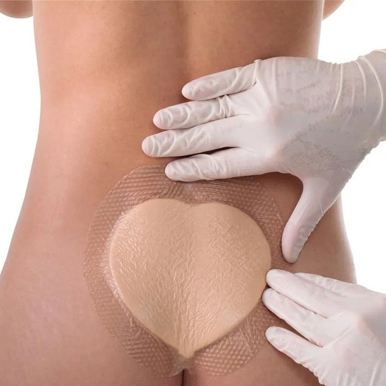 UNIMASTER Sacral Silicone Foam Dressing with Border for Sacrum Ulcer Pressure Ulcer High Absorbency Bedsore Wound Bandage