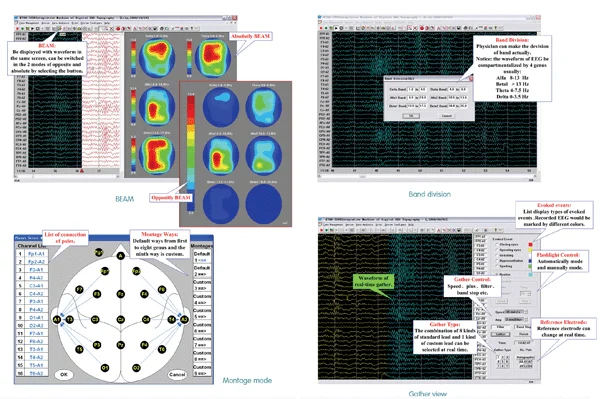 32 Channels Digital EEG System