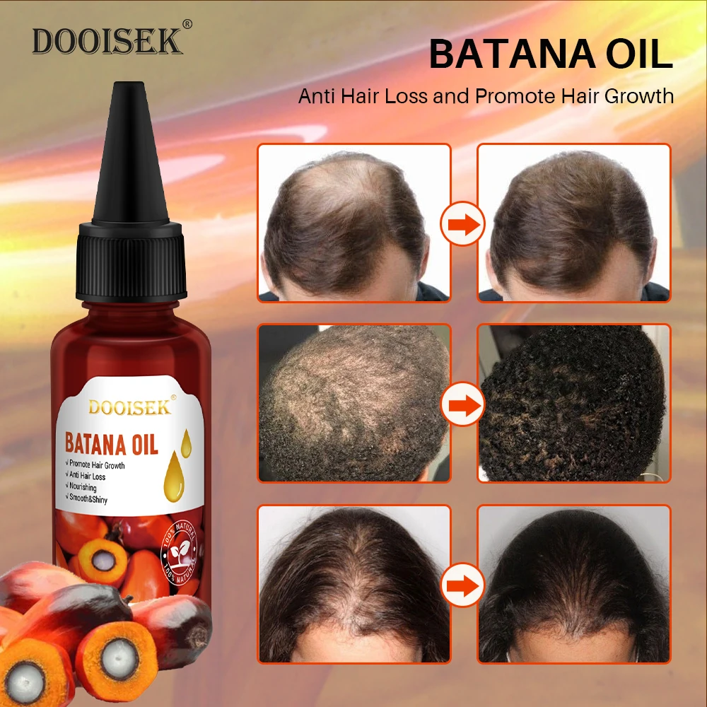 New Factory Pure Organic Batana Oil Repair Damaged Hair Promotes Strengthening Hair Growth Rosemary Hair Care Essential Oil