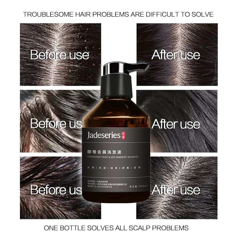 OEM/ODM custom spot natural organic private label shampoo wholesale price high quality anti-dandruff shampoo